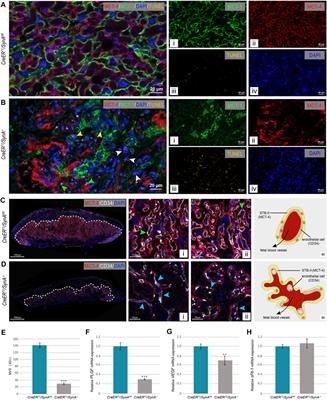 The Role of Syncytin in Placental Angiogenesis and Fetal Growth